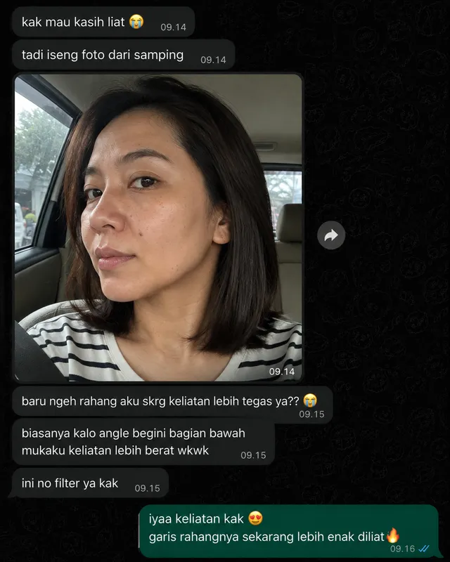 Testimoni WA: garis rahang kelihatan lebih tegas